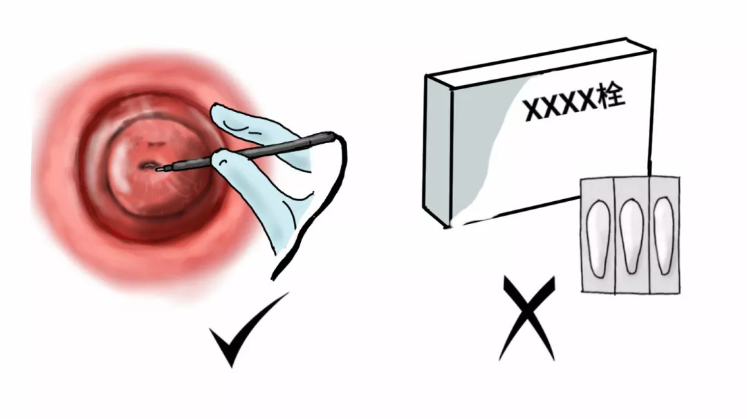 女性宫颈糜烂有什么症状和现象,宫颈糜烂用什么药好得快效果好