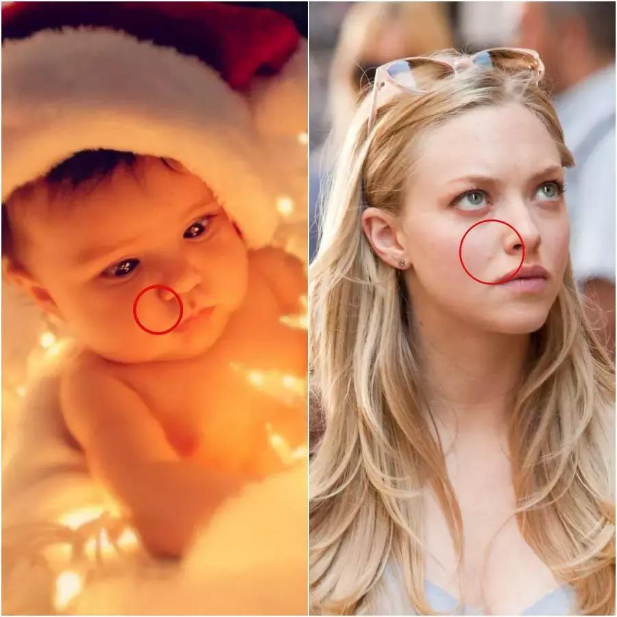 除了发量,最暴露年龄的可能是这两道纹