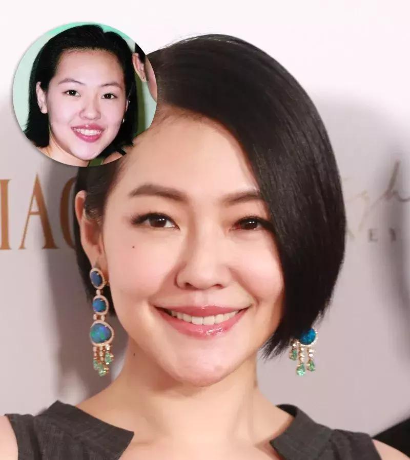 整牙后颜值明显变化的明星,明星真的会因为整牙而变漂亮了吗