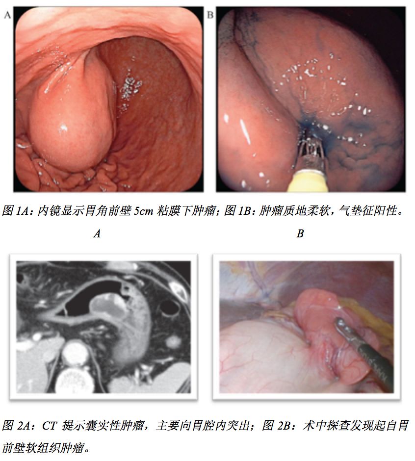 pubmed文献筛选,pubmed文献检索报告