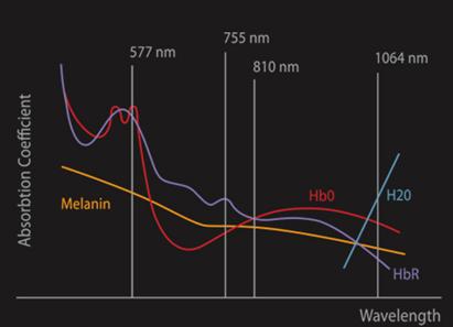 超冰脱毛用的什么机器,光滑肌肤脱毛效果好吗