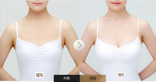 胸部下垂的拯救方法男,男人出轨是因为胸下垂么