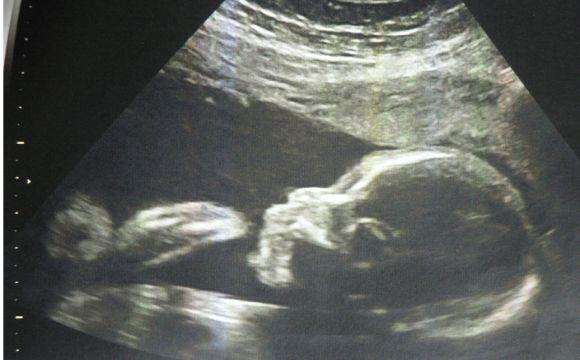 药流和人工流产哪个危害大,人工流产和宫腔镜哪个危害大