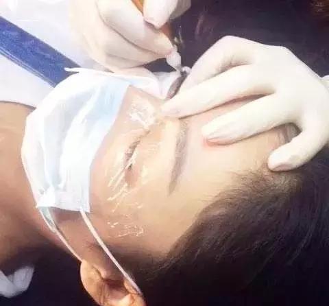 纹绣美瞳线操作流程,美瞳线视频全过程步骤