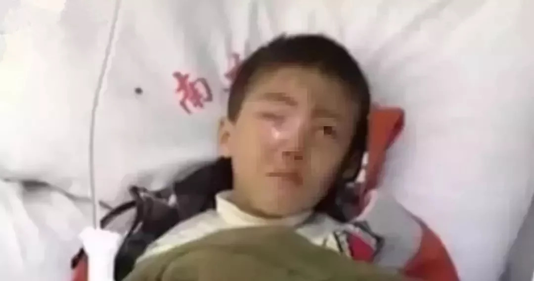 二十分钟孩子的眼球被溶解,孩子眼球被融化的东西很常见