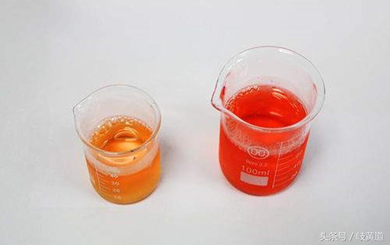 尿路感染有血尿吗怎么造成的,为什么急性尿路感染会出现血尿