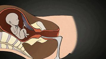 堕胎是杀人吗,堕胎就是杀生