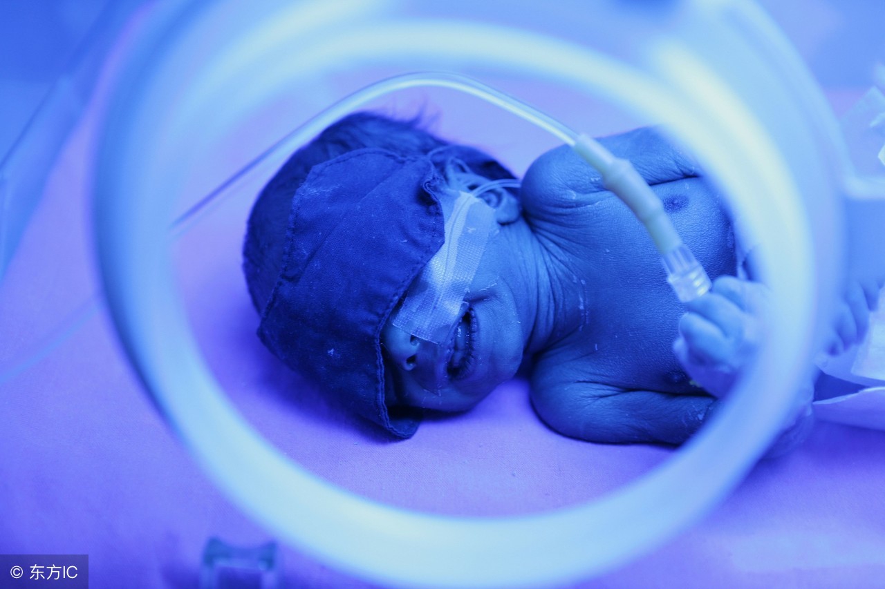 为什么婴儿晒太阳能退黄疸,新生儿黄疸晒太阳退了又反复了