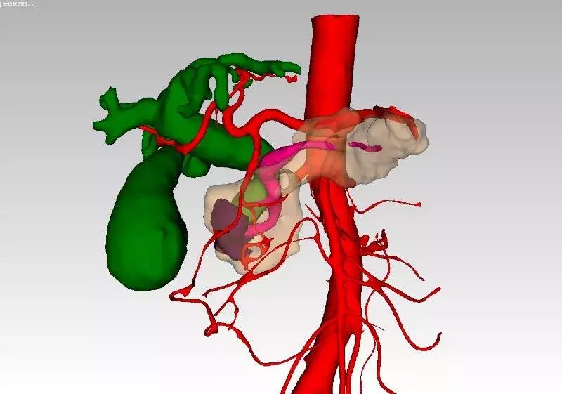 赞！这家医院再创清远首例！到底是什么让他们这么牛？