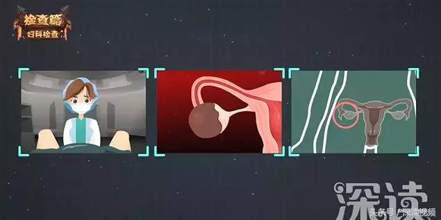 姨妈痛不痛与生孩子后遗症有关吗,姨妈痛不用药