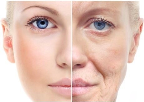 扒一扒如雷贯耳的“肉毒素”浙医四院老患者特别钟爱它的原因是……