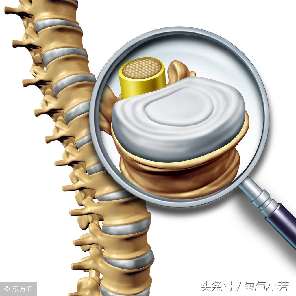腰突坐骨神经痛正确的拉筋,腰椎伸展受限怎么解决