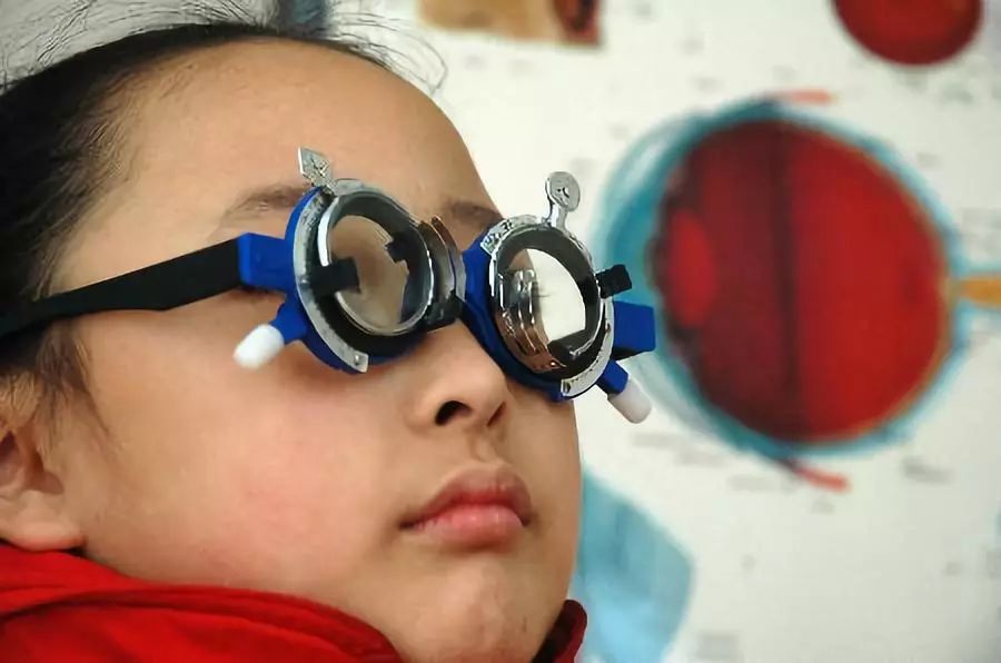 青少年近视弱视矫正,儿童近视1000多度加弱视能治好吗