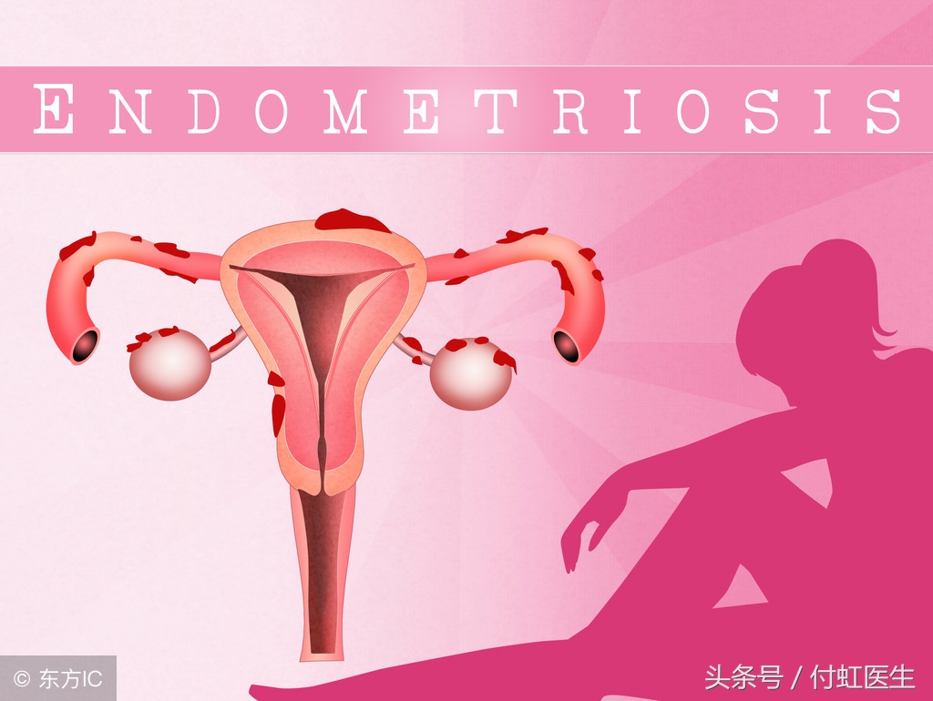 2cm的囊肿会导致痛经么,痛经一次比一次厉害怎么回事