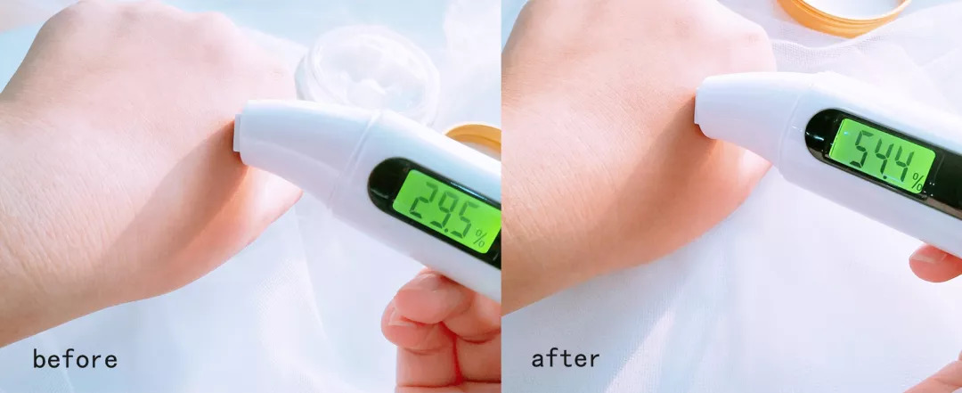 脱发算啥!90后已经开始长“老年斑”了,有人还为此花了10多万!