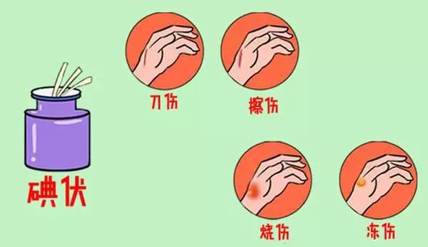 科普知识｜紫药水、红药水、酒精、碘伏……哪种处理伤口好？你可能一直都用错了