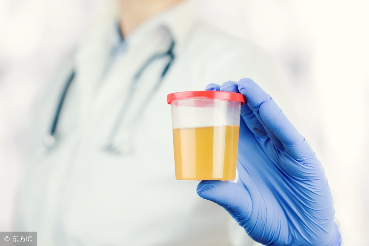 肾脏最全检查,肾脏早期受损什么检查能检查出来