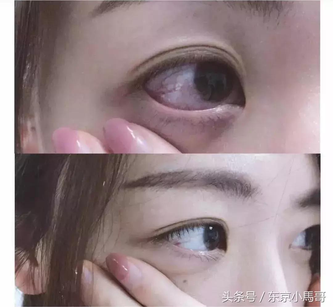 日本好用的祛红血丝眼药水 (日本爱马仕眼药水)