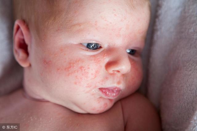 床上螨虫多?需一片叶子,不到1块钱,螨虫有多少死多少