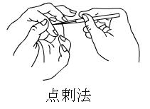 中医针刺疗法视频大全,三棱针的常用针刺方法