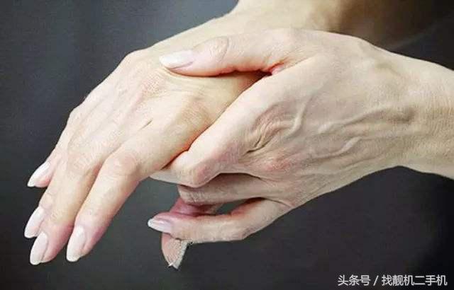 为什么人手上有青筋爆出来,50岁女人手上青筋暴起怎么回事