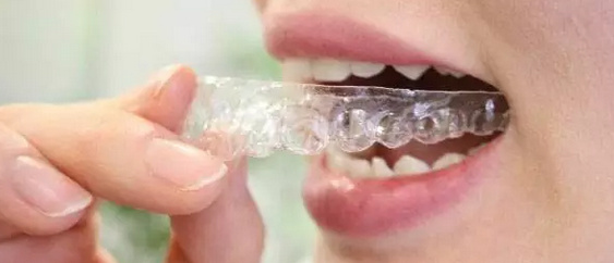 关于牙齿正畸你需要知道的5件事,关于牙齿你需要知道的三件事