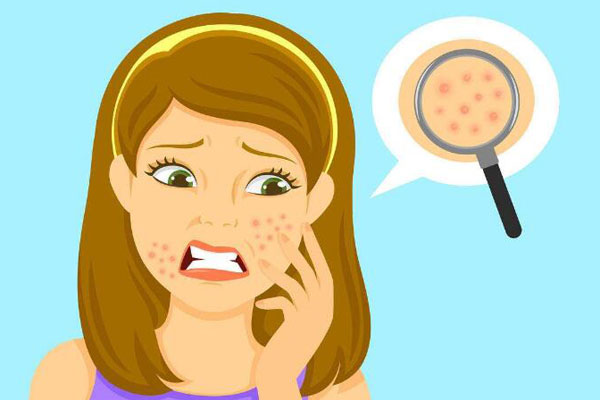 脸上小米粒大小的疙瘩怎么解决,脸上有小疙瘩像小米粒疙瘩