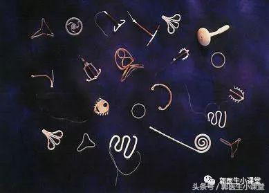 生完孩子结扎还是上环好,生完小孩就要上环吗