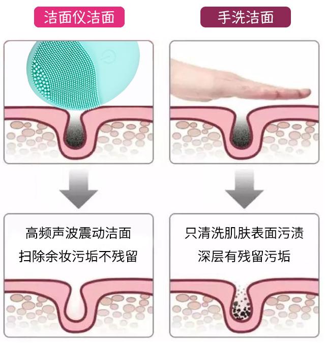 luna洁面仪德国版,luna洁面仪日版和韩版哪个好