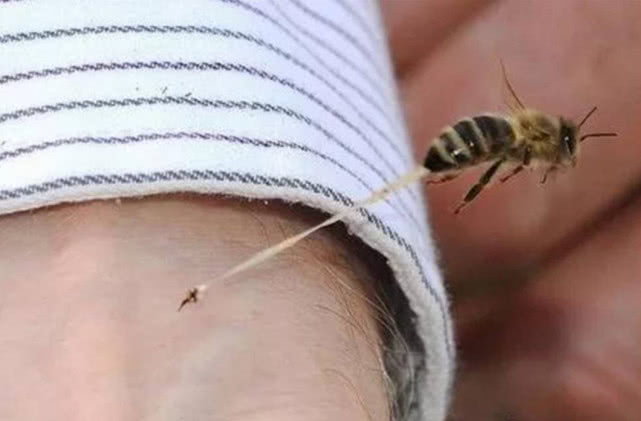 在农村被虫蜇到了怎么办,在农村被蜜蜂蛰了怎么办