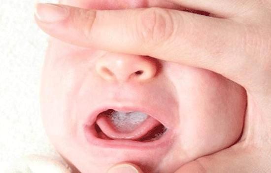 宝宝刚开始长牙哭闹如何缓解,宝宝长牙哭闹如何缓解