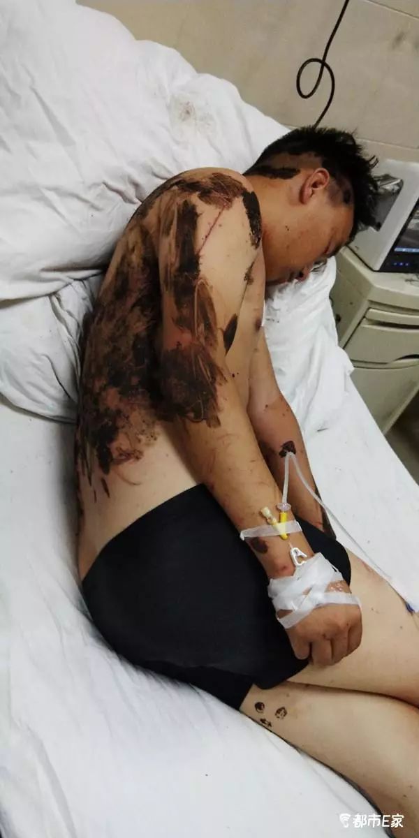 男子被马蜂蛰三下后去世,男子被黄蜂蜇致其身亡