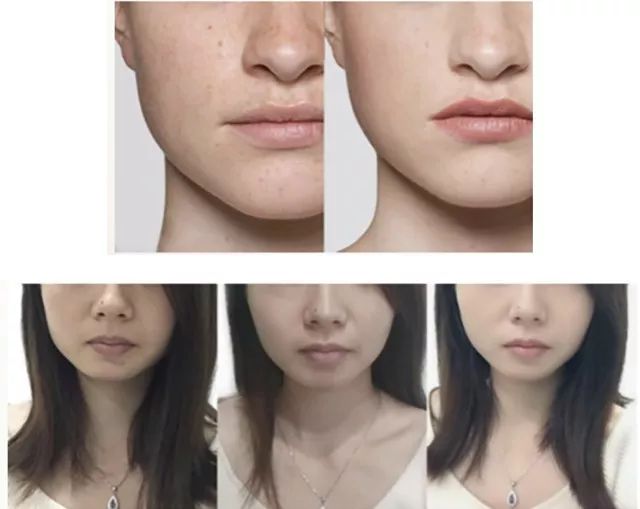 澳洲美白丸什么样的,澳洲美白丸最佳吃法