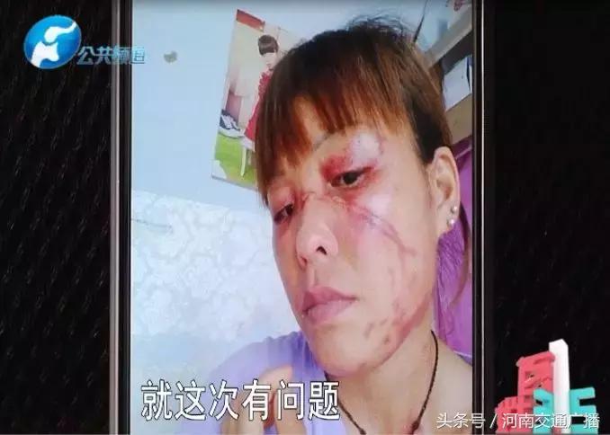 100块10盒面膜毁容事件,女人惨遭毁容后续