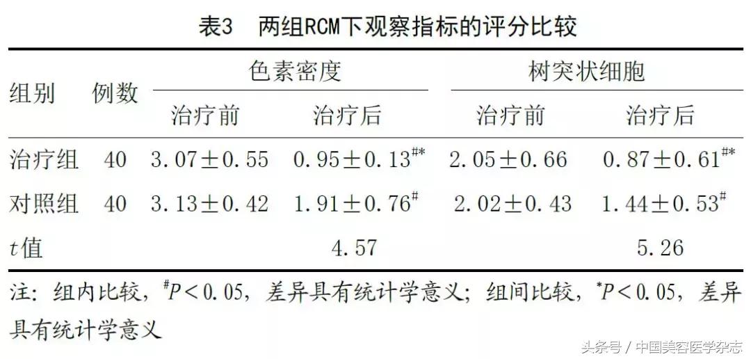 中药调理褐斑一般多久能见效,中药和针灸调理黄褐斑