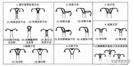 畸形子宫怀孕,t型子宫畸形能怀孕吗