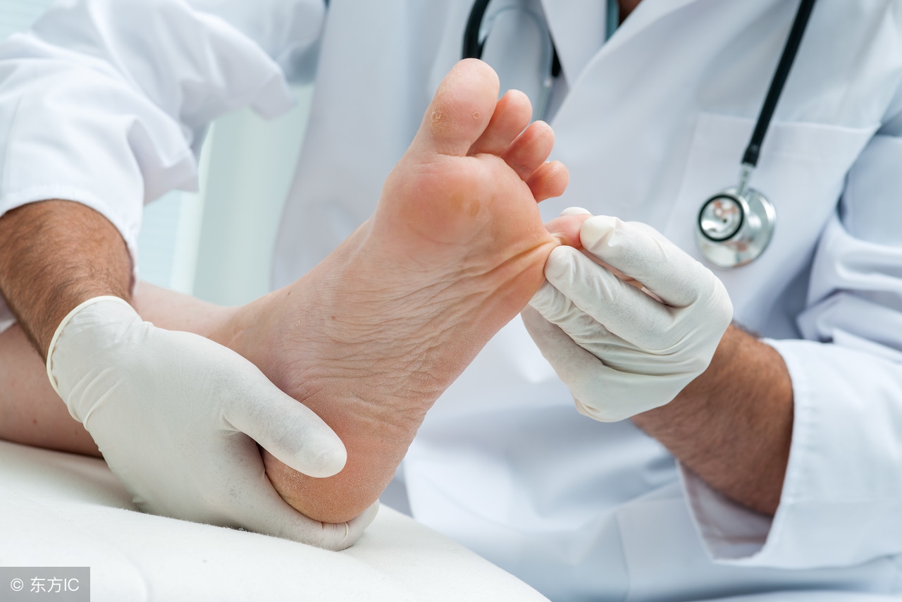 脚气和脚癣的症状,脚气是足癣吗发生在什么季节