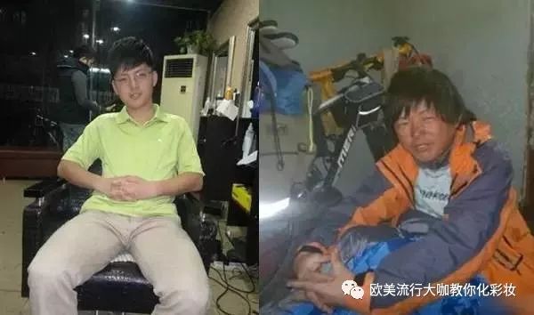 身体晒伤后快速修复的十大妙招,孩子被太阳晒伤皮肤发红急救方法