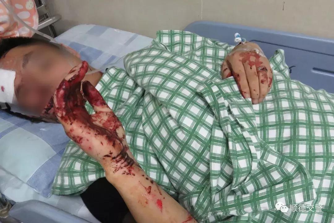 顺德这辆百万玛莎拉蒂被撞爆车头,玛莎拉蒂晚上被撞