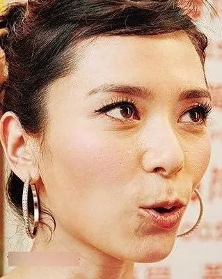 晒黑怎样快速恢复美白,假期晒黑如何美白