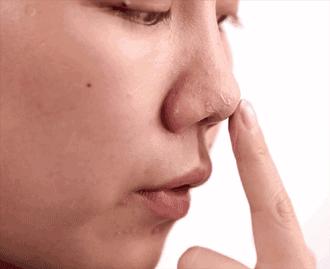 战痘技巧｜林允儿和小甜甜的痘痘可不是一回事