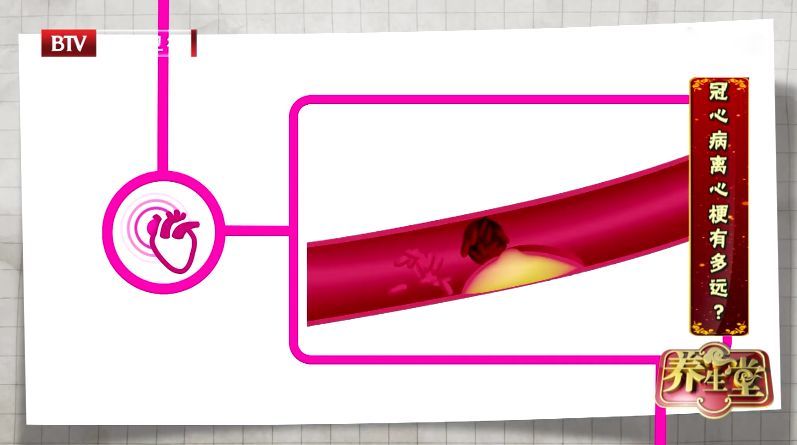 胸痛突发,感到胸痛要警惕四种病