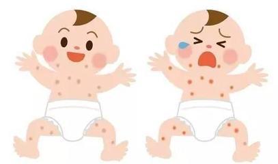宝宝春季皮肤湿疹干痒预防方案,秋冬季节干燥宝宝湿疹高发