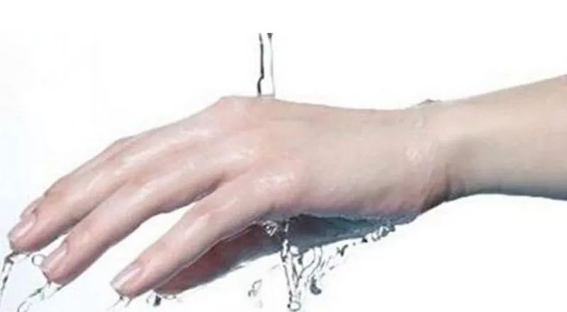 宝宝被开水烫伤妈妈去救他,婴儿被100开水烫伤后续