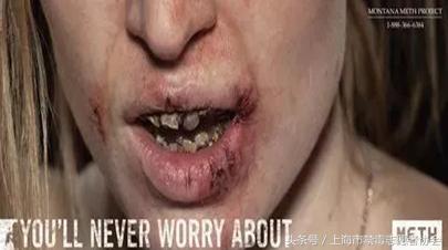 毒言毒语大全,一口烂牙你们郁闷吗