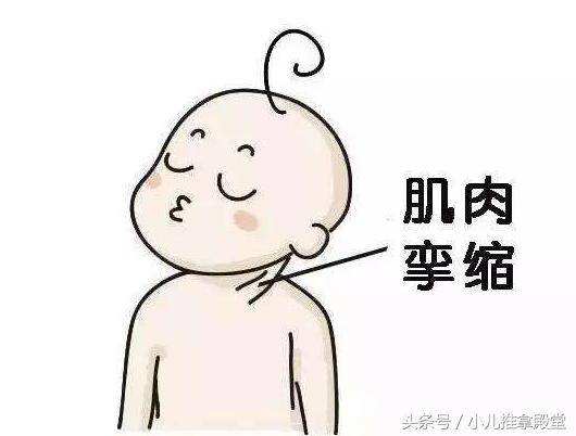 治疗小儿斜颈最好医院,斜颈分哪种类型