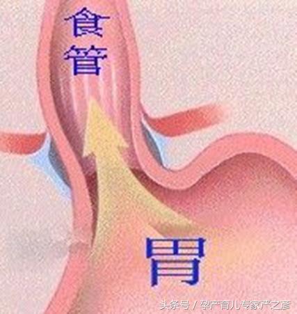 8个月宝宝吞咽辅食困难怎么办,宝宝吃辅食吞咽能力差怎么办