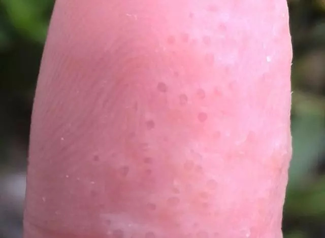 钓鱼遇到最痛苦的事情,钓鱼容易受伤吗