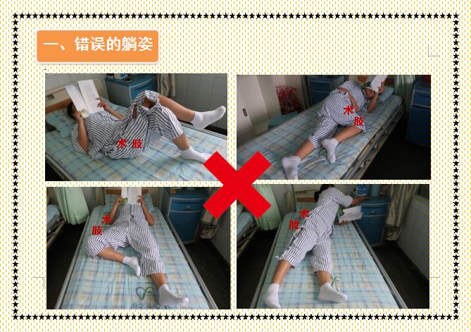 人工髋关节置换术前准备护理,人工髋关节置换术的健康宣教手册