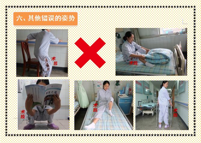 人工髋关节置换术前准备护理,人工髋关节置换术的健康宣教手册